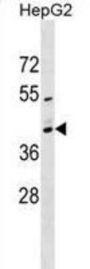 Mitochondrial Ribosomal Protein S2 (MRPS2) Antibody