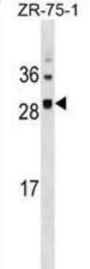 Kinetochore Protein Spc25 (SPC25) Antibody