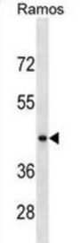 RGM Domain Family Member B (RGMB) Antibody