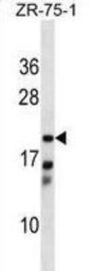 Carbonyl Reductase Family Member 4 (CBR4) Antibody
