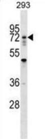 Ring Finger Protein 112 (RNF112) Antibody