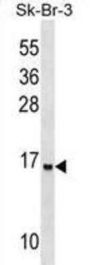 Urotensin-2B (UTS2D) Antibody