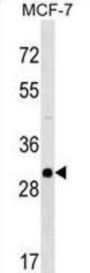 RAB26 Antibody