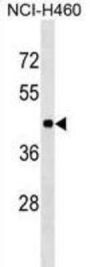 Torsin Family 3 Member A (TOR3A) Antibody