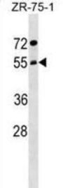 Archain 1 (ARCN1) Antibody