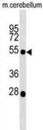 ATP-Sensitive Inward Rectifier Potassium Channel 12 (KCNJ12) Antibody
