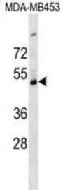 Serpin I2 (SERPINI2) Antibody