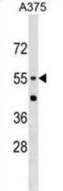 CNDP1 Antibody