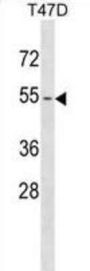 Keratin, Type II Cytoskeletal 79 (KRT79) Antibody