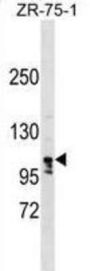 La Ribonucleoprotein Domain Family Member 1B (LARP1B) Antibody