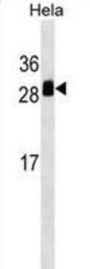 Transmembrane Emp24-Domain Containing Protein 1 (TMED1) Antibody