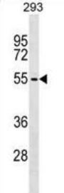 Zinc Finger And BTB Domain-Containing Protein 6 (ZBTB6) Antibody