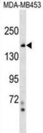 NF-Kappa-B Inhibitor-Like Protein 2 (NFKBIL2) Antibody