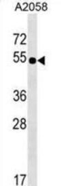 NHEDC2 Antibody