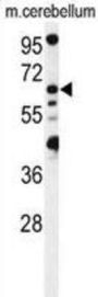 Vacuolar Fusion Protein MON1 Homolog B (MON1B) Antibody