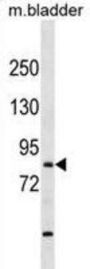 T-Box, Brain 1 (TBR1) Antibody