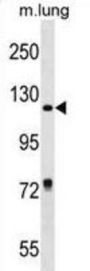 Retinol Binding Protein 3, Interstitial (RBP3) Antibody