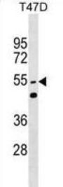 Heterogeneous Nuclear Ribonucleoprotein L-Like (HNRPLL) Antibody
