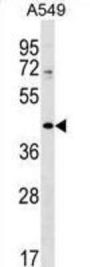 ZNF25 Antibody