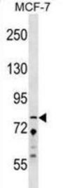 Zinc Finger Protein 828 (ZNF828) Antibody