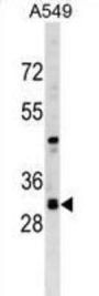 RASSF3 Antibody