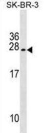 TUSC5 Antibody