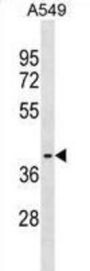 Zinc Finger Protein 514 (ZNF514) Antibody