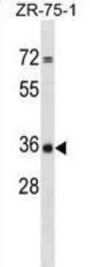 CPPED1 Antibody