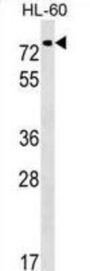 Polypeptide N-Acetylgalactosaminyltransferase 9 (GALNT9) Antibody