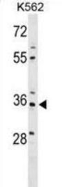 PDZ And LIM Domain 4 (PDLIM4) Antibody