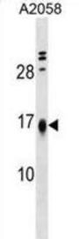 LBH Antibody