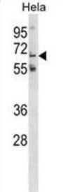 Polypeptide N-Acetylgalactosaminyltransferase 11 (GLT11) Antibody