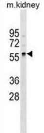 Polypeptide N-Acetylgalactosaminyltransferase 11 (GLT11) Antibody