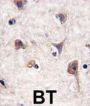 Microtubule-Associated Proteins 1A/1B Light Chain 3A (MAP1LC3A) Antibody