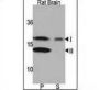 Microtubule-Associated Proteins 1A/1B Light Chain 3A (MAP1LC3A) Antibody