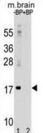 Microtubule-Associated Proteins 1A/1B Light Chain 3A (MAP1LC3A) Antibody