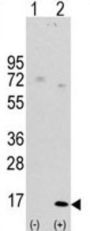 Microtubule-Associated Proteins 1A/1B Light Chain 3A (MAP1LC3A) Antibody