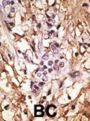 Microtubule-Associated Proteins 1A/1B Light Chain 3A (MAP1LC3A) Antibody
