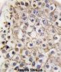 Microtubule-Associated Proteins 1A/1B Light Chain 3A (MAP1LC3A) Antibody