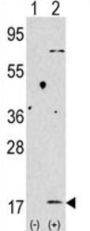 Microtubule-Associated Proteins 1A/1B Light Chain 3A (MAP1LC3A) Antibody