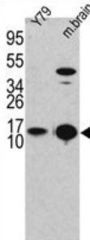 Microtubule-Associated Proteins 1A/1B Light Chain 3A (MAP1LC3A) Antibody