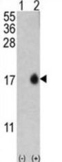 Microtubule-Associated Proteins 1A/1B Light Chain 3A (MAP1LC3A) Antibody