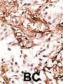 Microtubule-Associated Proteins 1A/1B Light Chain 3A (MAP1LC3A) Antibody