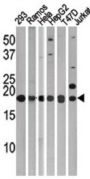 Microtubule-Associated Proteins 1A/1B Light Chain 3A (MAP1LC3A) Antibody