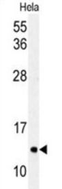 Microtubule-Associated Proteins 1A/1B Light Chain 3A (MAP1LC3A) Antibody
