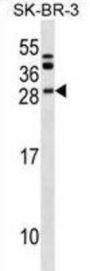 B-Cell CLL/lymphoma 7 Protein Family Member C (BCL7C) Antibody