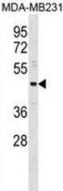 One Cut Domain Family Member 3 (ONECUT3) Antibody