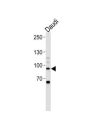 Signal Transducer And Activator of Transcription 3 (STAT3) Antibody