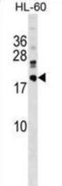 DnaJ Homolog Subfamily C Member 30 (DNAJC30) Antibody