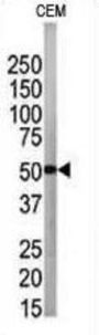Autophagy Related 4B Cysteine Peptidase (ATG4B) Antibody